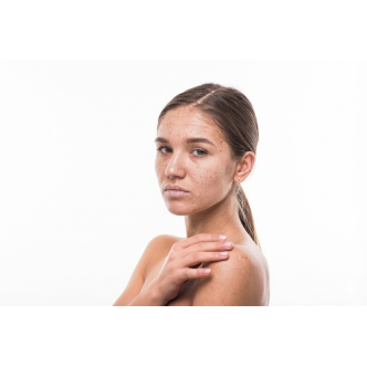 copy of Camomila Intea® Shampoo BLONDSCHIMMER für blondes Haar